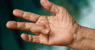 Trigger Finger