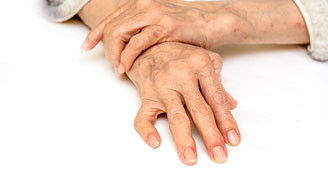 Osteoporosis Hands